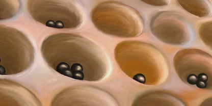 "Your Move" - Canvas Art